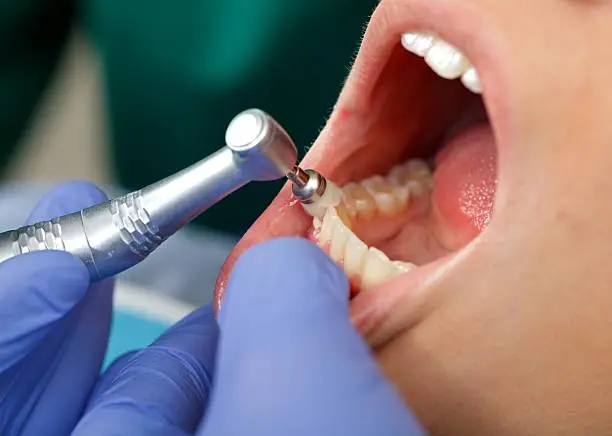 dental-cleanings-near-you