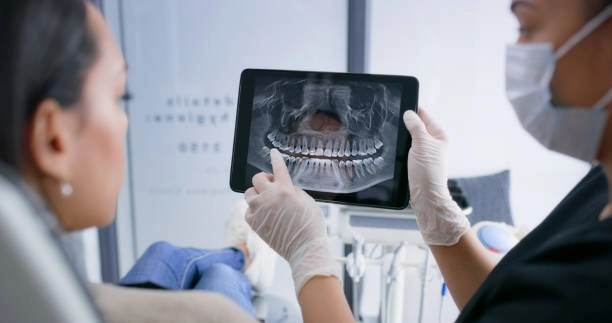 dental-xrays-in-ottawa-ontario