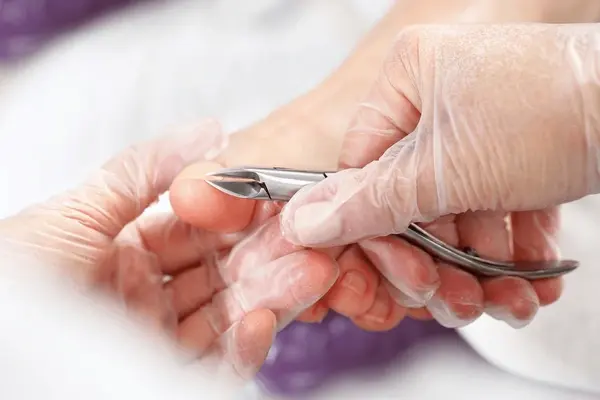 nail reduction in austral, nsw