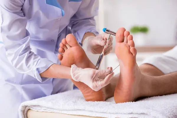 wart debridement in austral, nsw