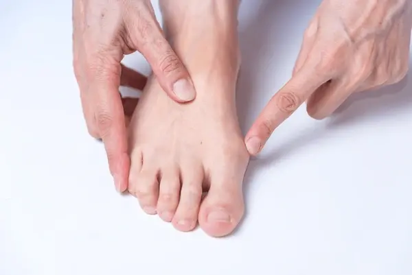 bunion treatment near you
