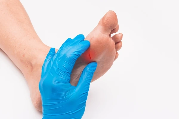 diabetic wound care in chino hills ca