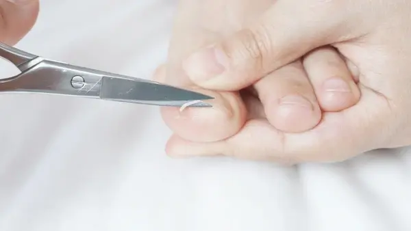 ingrown toenail treatment near you