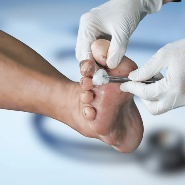 wound care treatment near you