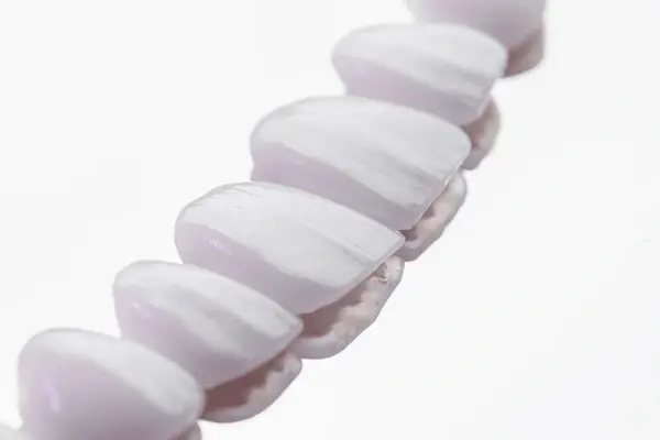 dental veneers near you