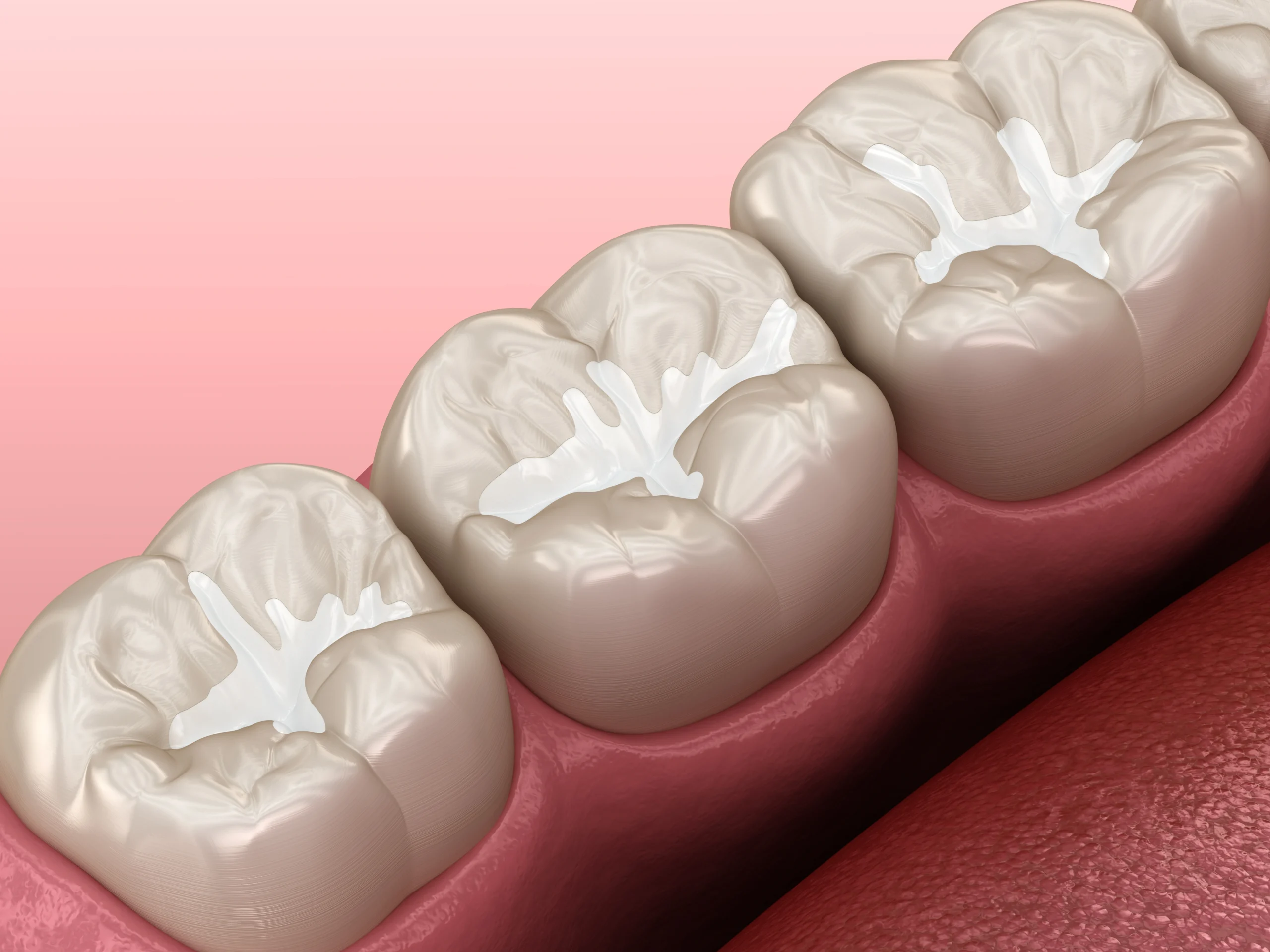 dental fillings near you