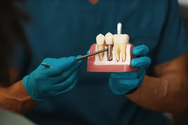 dental implants in leduc, ab
