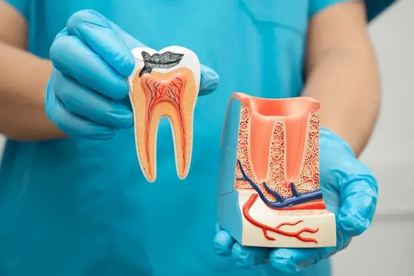 root canal treatment in leduc, ab