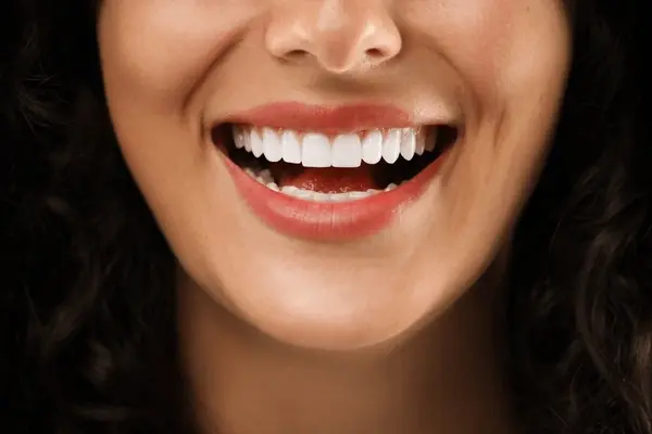 teeth whitening in leduc, ab