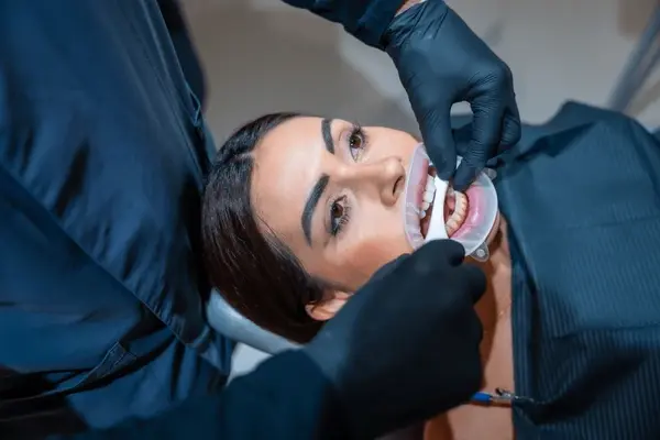 teeth whitening near you