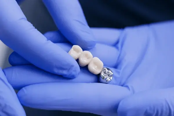 dental bridges near you