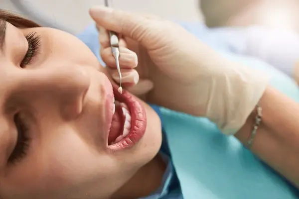 dental fillings near you