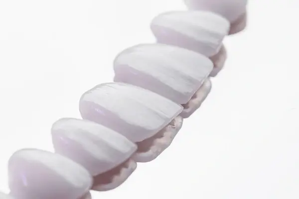 dental veneers in downtown markham