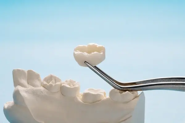 same day crowns near you