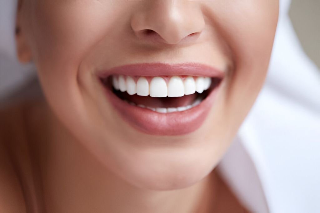 Dental bonding procedure at a dental clinic in Keswick.