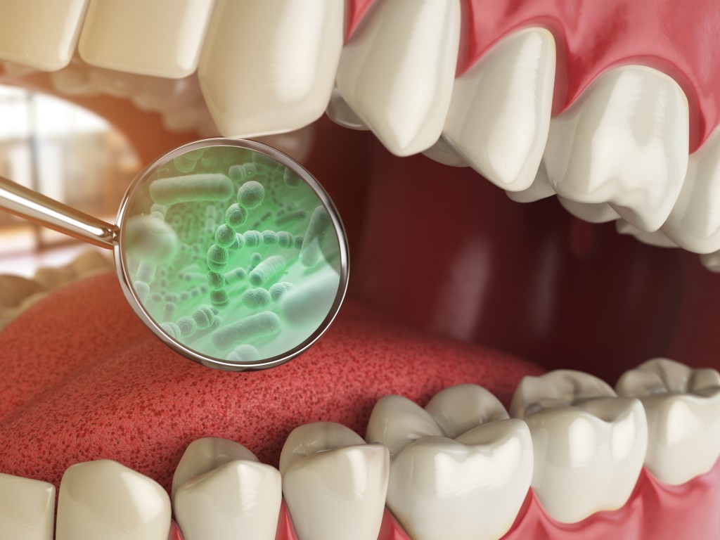 Guided Biofilm Therapy in Keswick