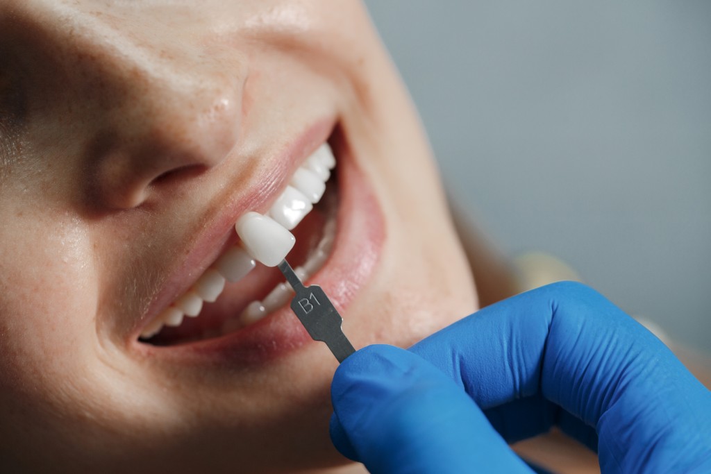 Dentist performing Porcelain Veneers in Keswick, applying veneers to a patient's teeth for smile enhancement.