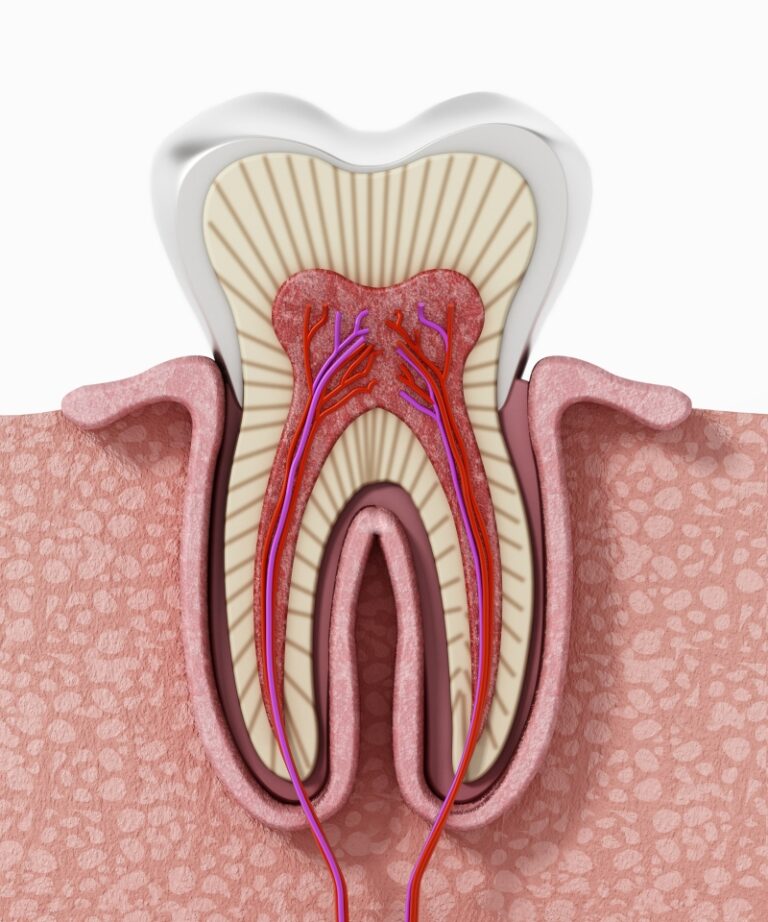 Root Canal Therapy in Keswick