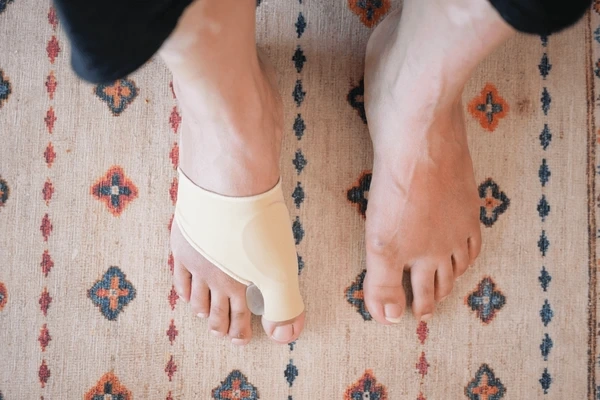 bunion treatment in upland, ca