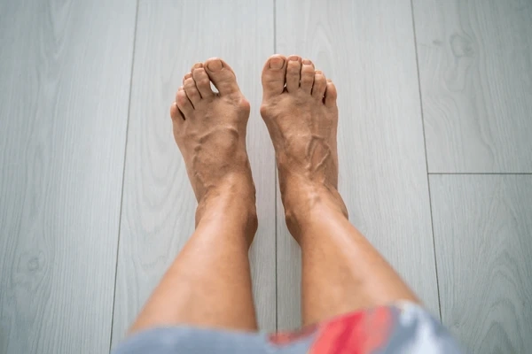 bunion treatment near you