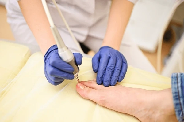 fungal toenail treatment near you