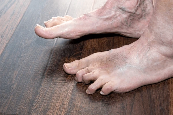 hammertoe treatment near you