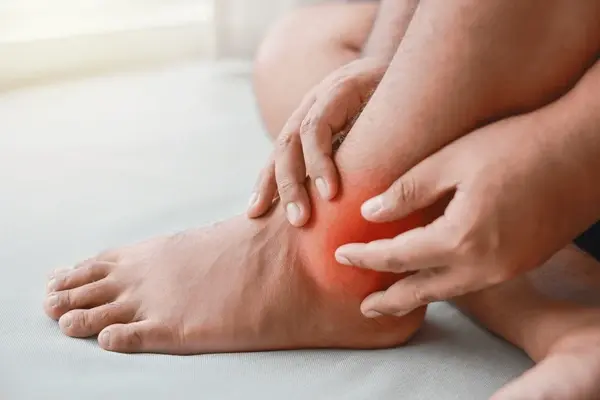 treatment for swollen feet and ankles in upland, ca