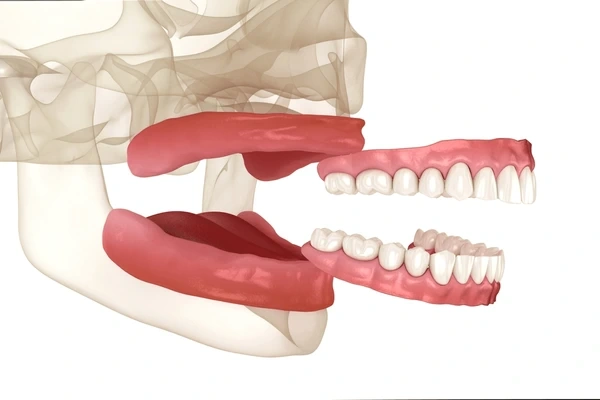 dentures in mississauga on