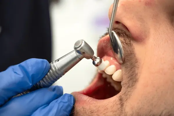 teeth cleaning near you