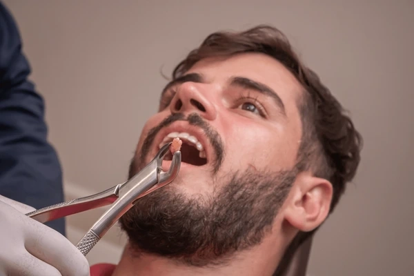 wisdom tooth extraction near you