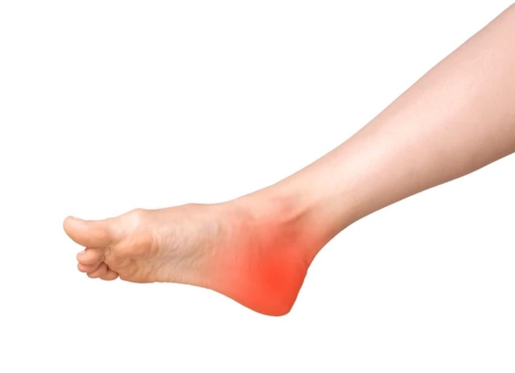 heel pain treatment in valrico fl