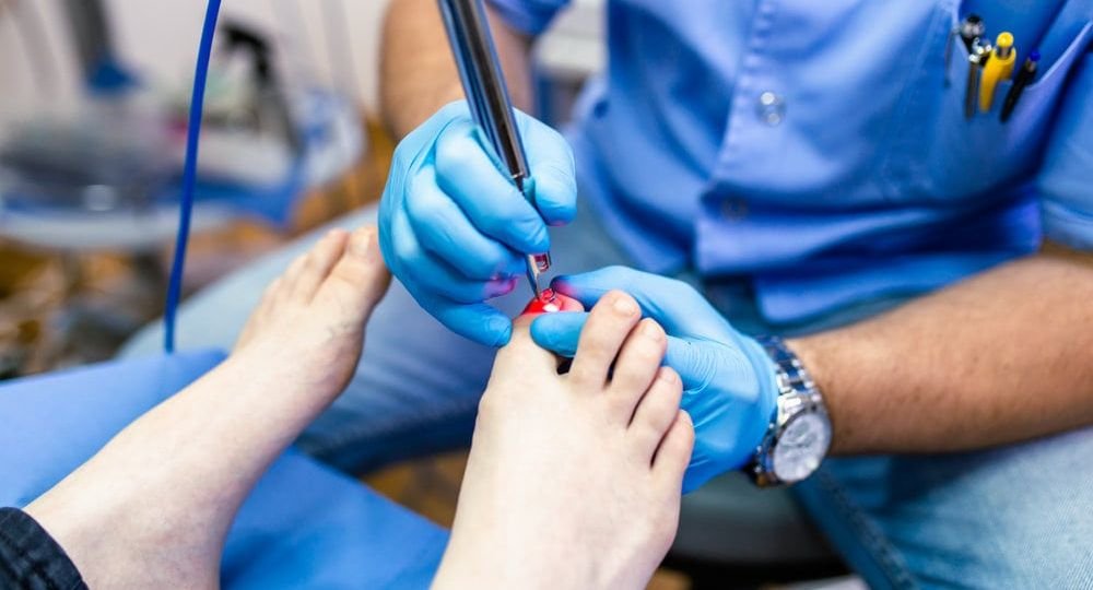 effective is the laser toenail fungus treatment