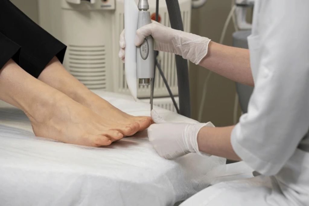 laser therapy for toenail fungus near you