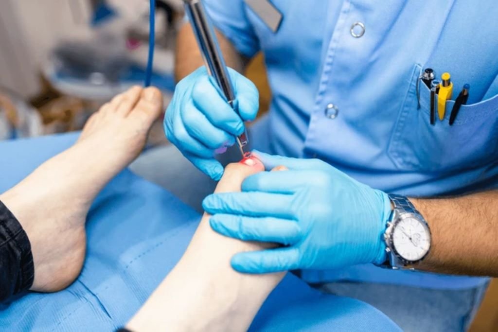 laser toenail fungus treatment near you