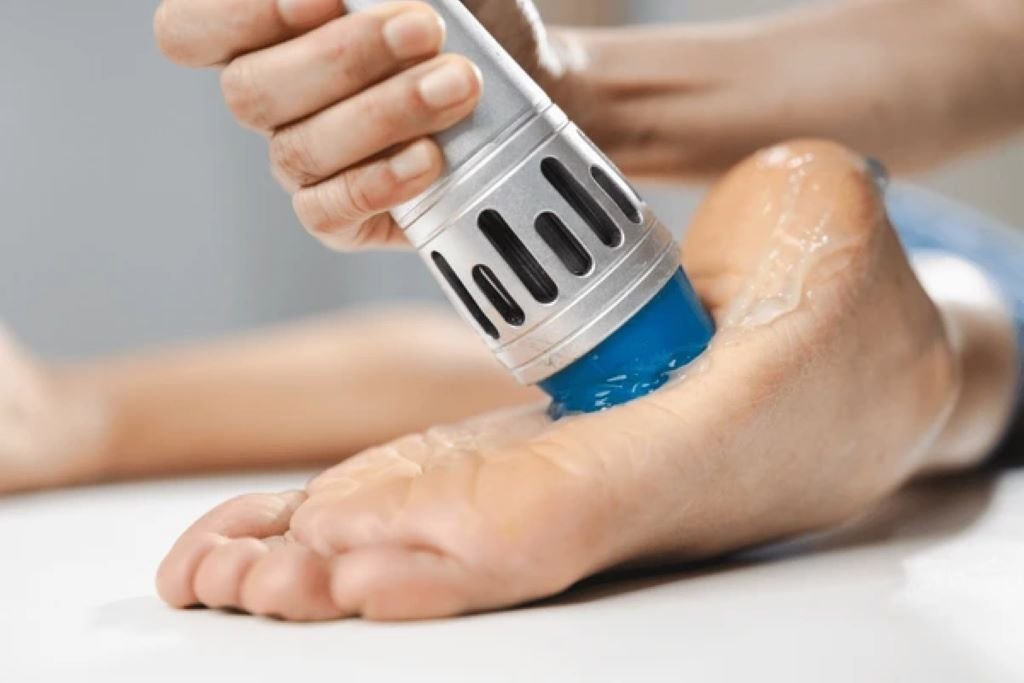 shockwave therapy in valrico fl