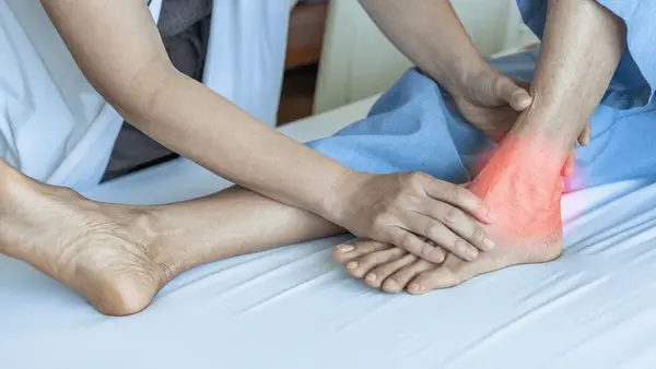ankle instability treatment in orlando and kissimmee, fl
