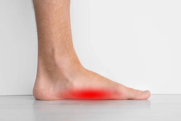 flat feet treatment near you