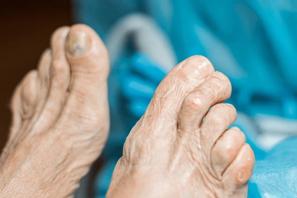 geriatric foot care in orlando and kissimmee, fl