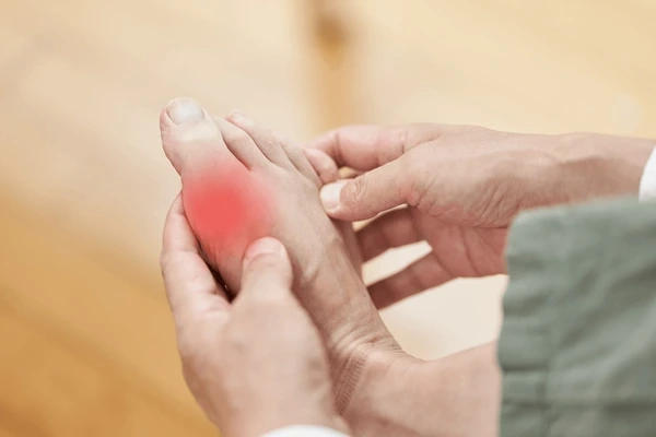 gout treatment near you