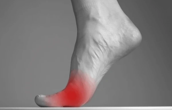 neuroma treatment near you