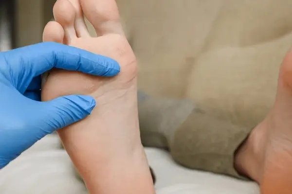 surgical corrections of foot disorders in orlando and kissimmee, fl