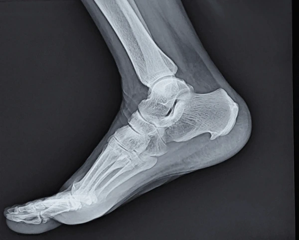x-rays in orlando and kissimmee, fl