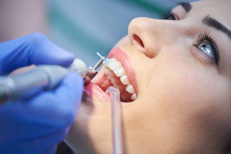 a dental patient undergoing a teeth cleaning procedure, with dental tools in her mouth, for her preventative dentistry needs.
