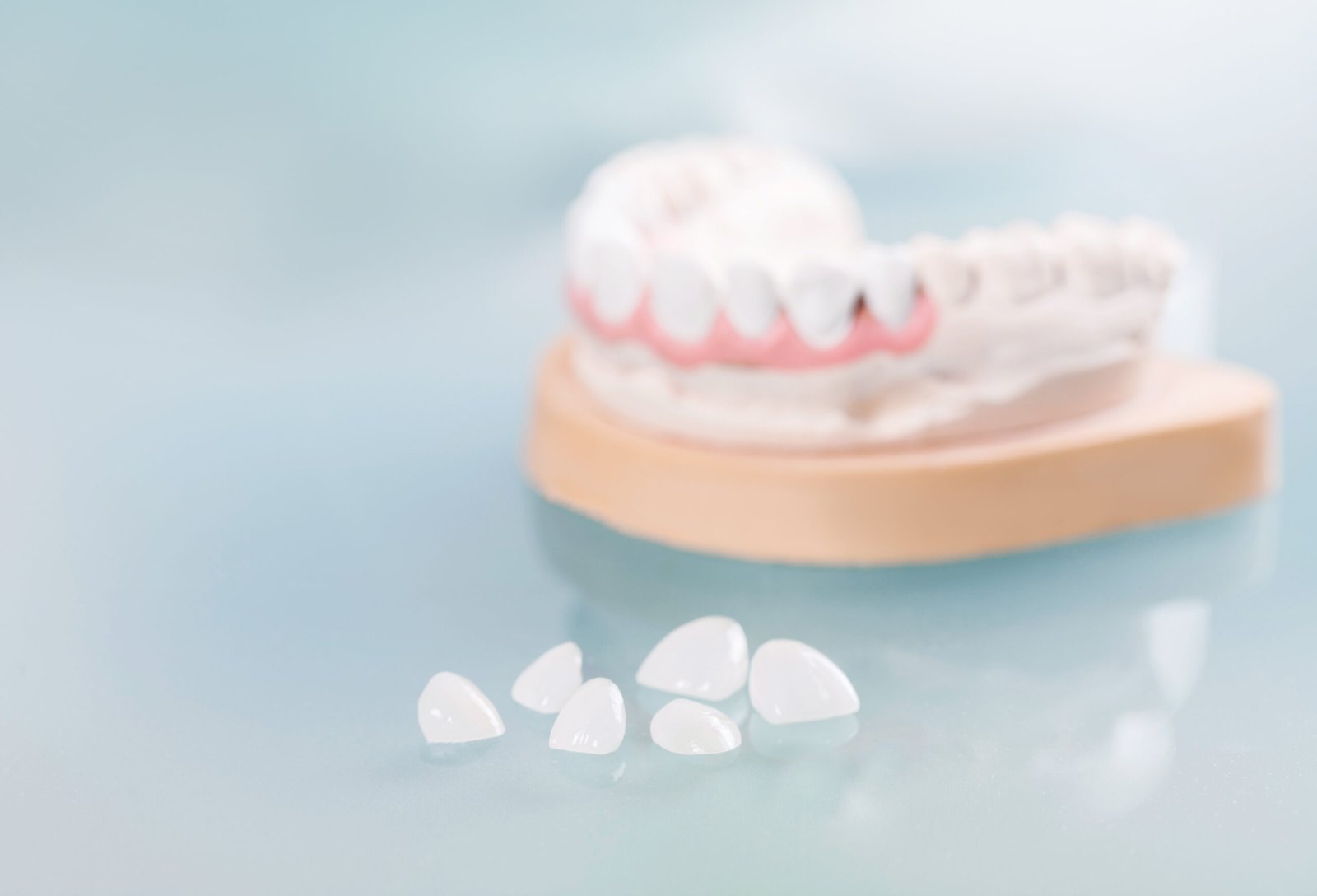An image of porcelain veneers.