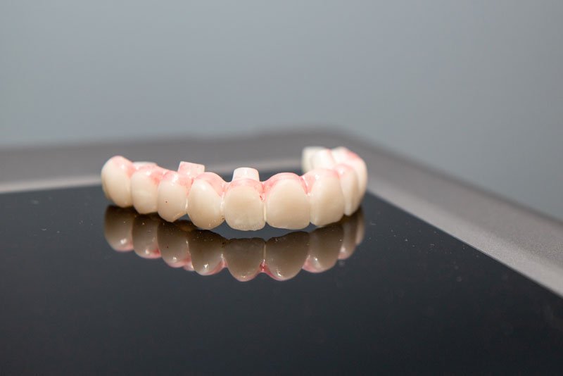 A full arch dental implant model displayed on a reflective surface, showing artificial teeth and gum structure.