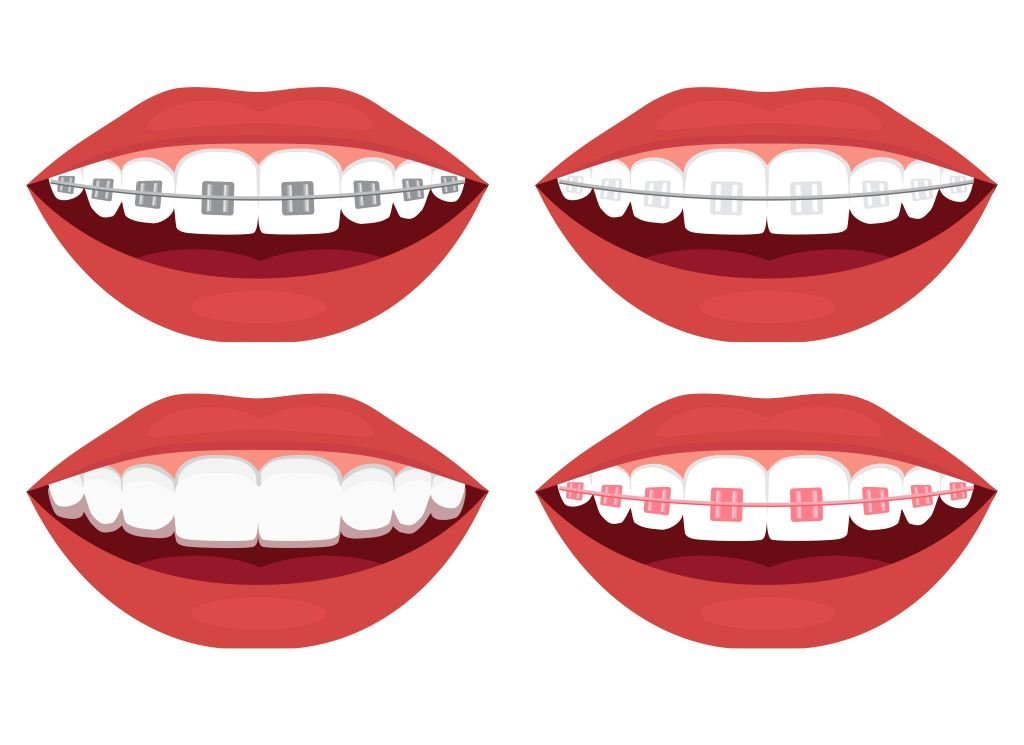 orthodontics in red hill