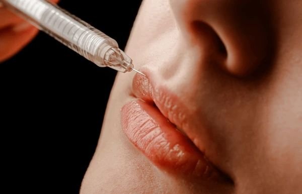 ha dermal filler treatments in south core toronto