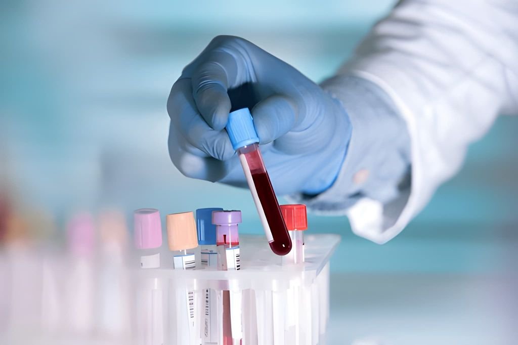blood lab & cardiology testing in south core toronto