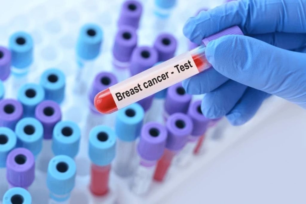 genetic & biomarker testing in south core toronto