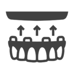 all-on-4 implants folsom